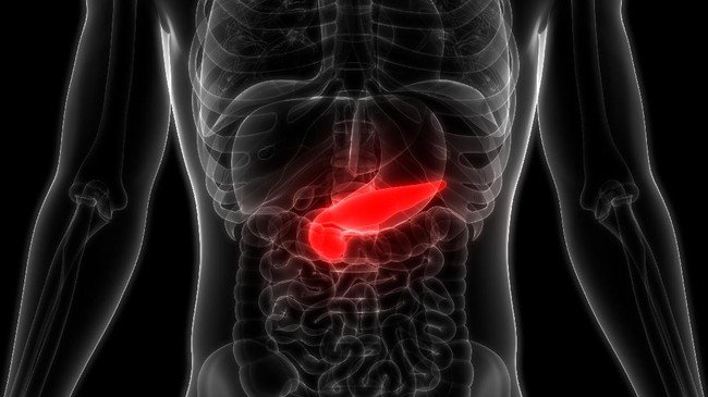 Advanced Stage Pancreatic Cancer: Symptoms to Watch Out For